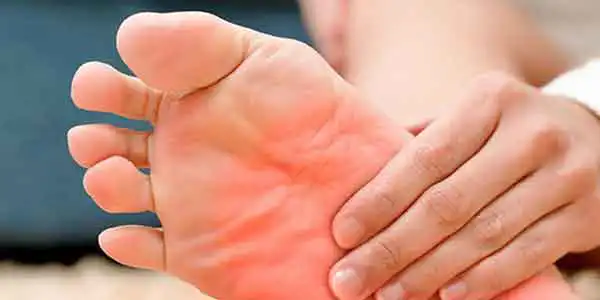 تعبیر خواب داغ کردن برای زن متاهل + برای مرد و زن متاهل و پسر و دختر مجرد