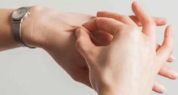 تعبیر خواب نیشگون برای زن متاهل + برای مرد و زن متاهل و پسر و دختر مجرد